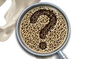 Bone Medical Questions